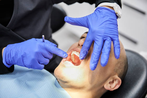 Best Emergency Broken Tooth Repair in Limon, CO